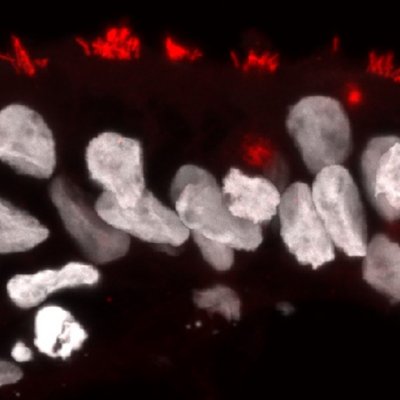 A microscopic view of brain organoids 